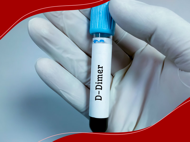 imagem de frasco de exame de sangue d-dimer, para diagnóstico de embolia