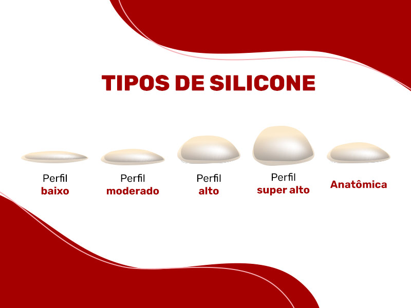 Ilustração que mostra os 5 tipos de silicone diferentes para a mamoplastia de aumento.