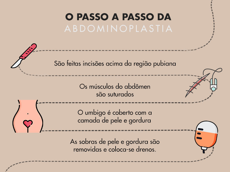 Tudo Sobre Abdominoplastia Guia Completo Dream Plastic