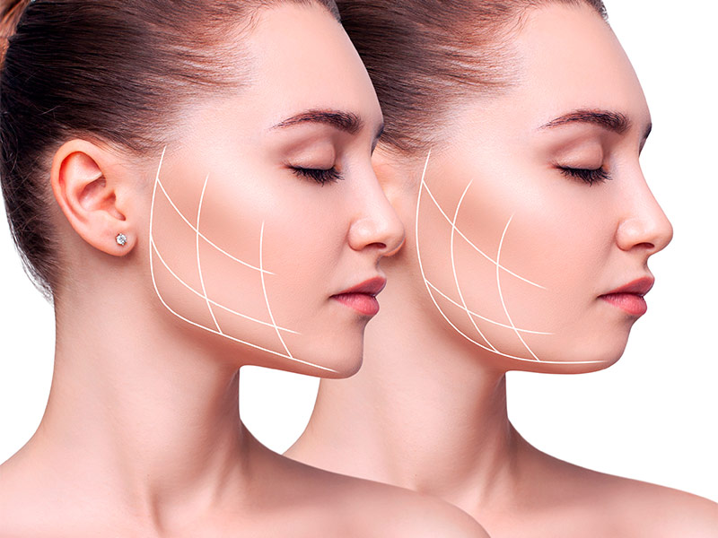 Harmonização facial antes e depois: quais são os cuidados?
