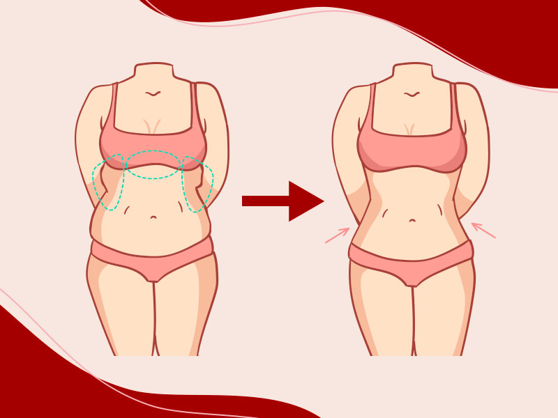 Ilustração que mostra como fica o antes e depois da abdominoplastia reversa