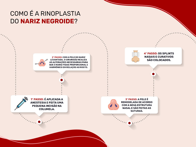 Ilustração que mostra como é a rinoplastia do nariz negroide