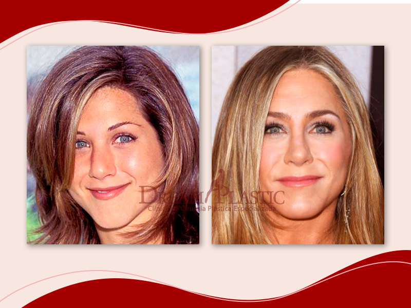 Antes e depois da atriz Jennifer Anniston