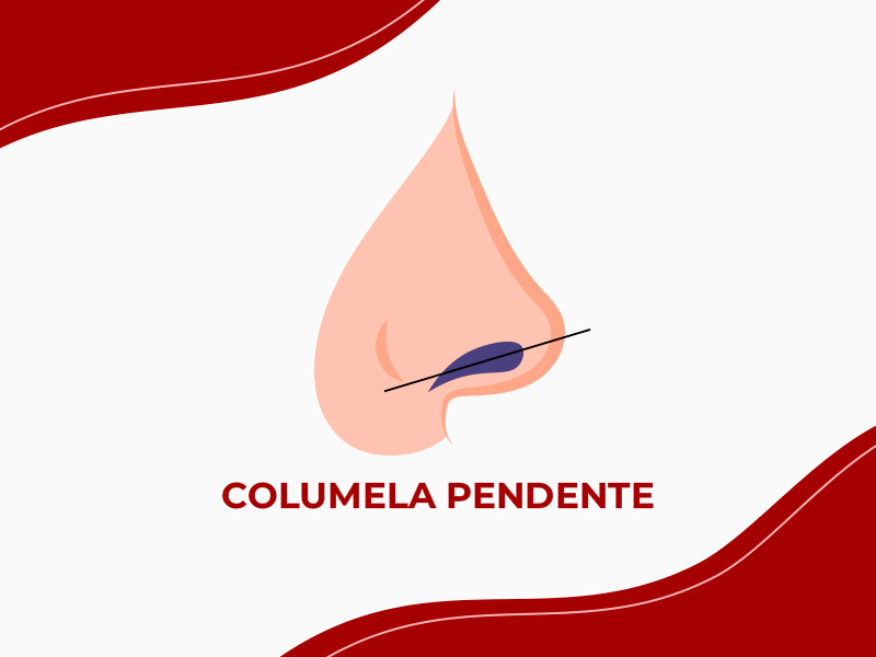 ilustração de columela pendente