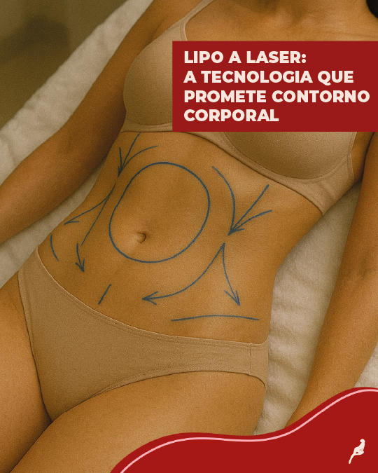 Como a lipoaspiração a laser atua no contorno do corpo Ilustração com áreas tratadas por lipo a laser, destacando o contorno corporal com tecnologia não invasiva