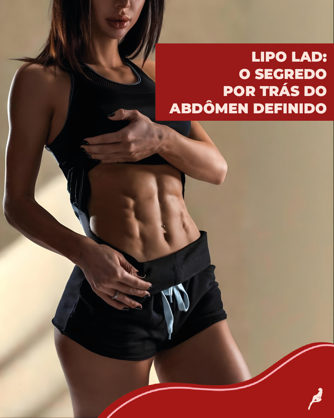 Definição abdominal alcançada com lipo LAD Resultado da lipo LAD com contorno muscular visível em paciente com definição abdominal
