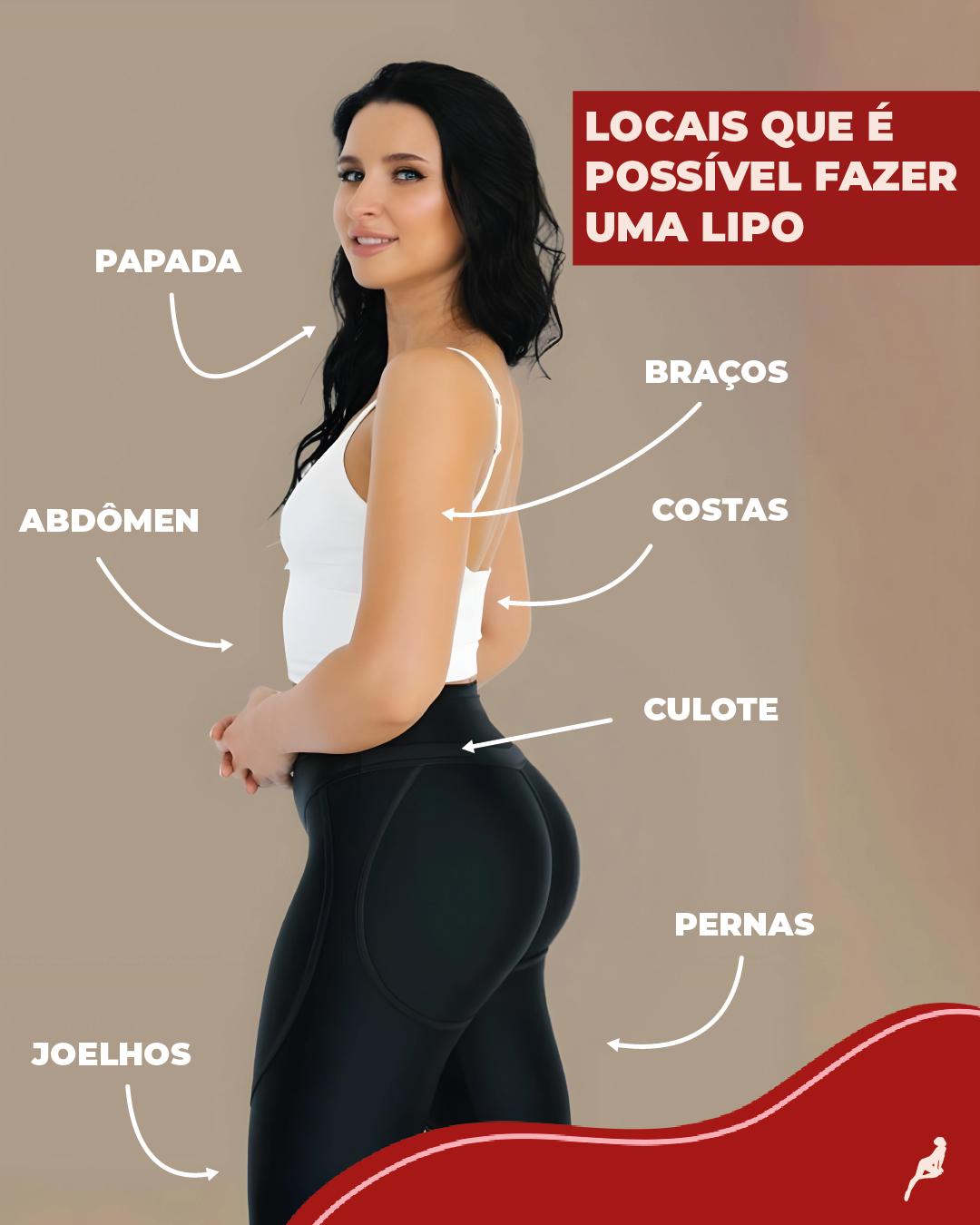 Áreas do corpo onde é possível fazer lipoaspiração com segurança Mulher com marcações nas principais regiões onde a lipoaspiração pode ser realizada