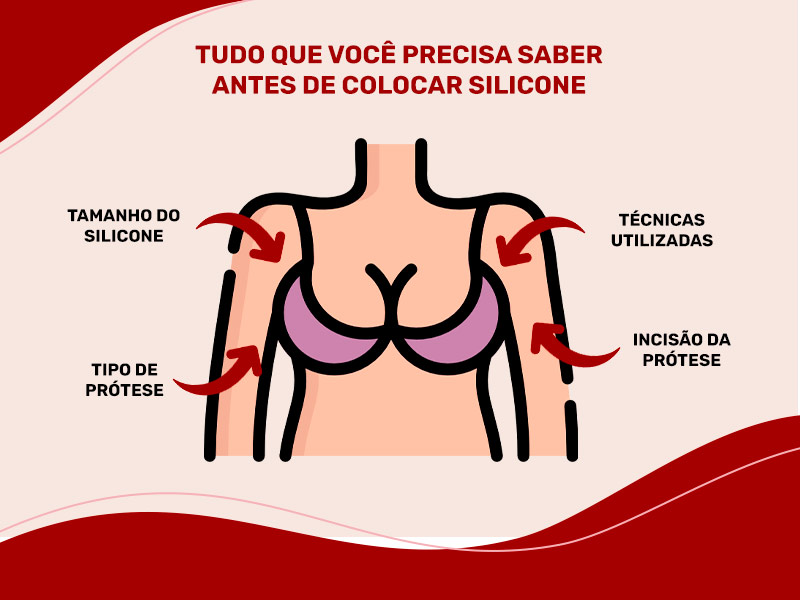 O que você precisa saber antes de colocar silicone? Ilustração que mostra o que você precisa saber antes de colocar silicone, como o tamanho, tipo de prótese e incisão.