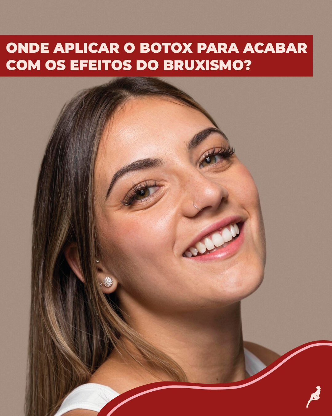 Pontos de aplicação pontos de aplicação do botox para bruxismo