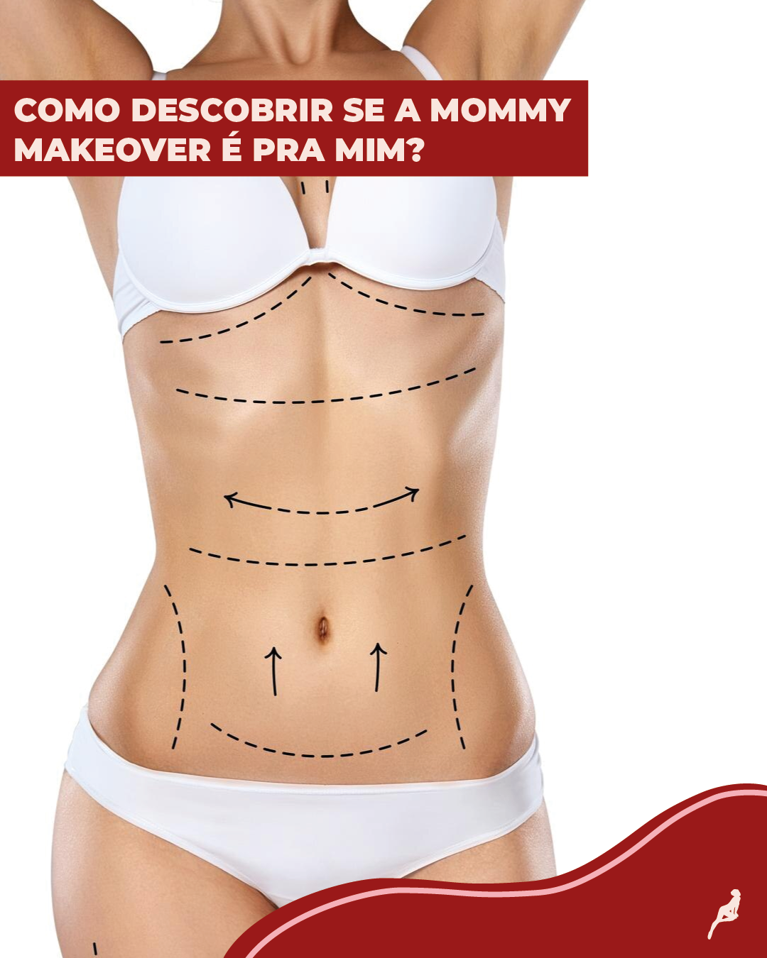 O que é mommy make over? mommy makeover