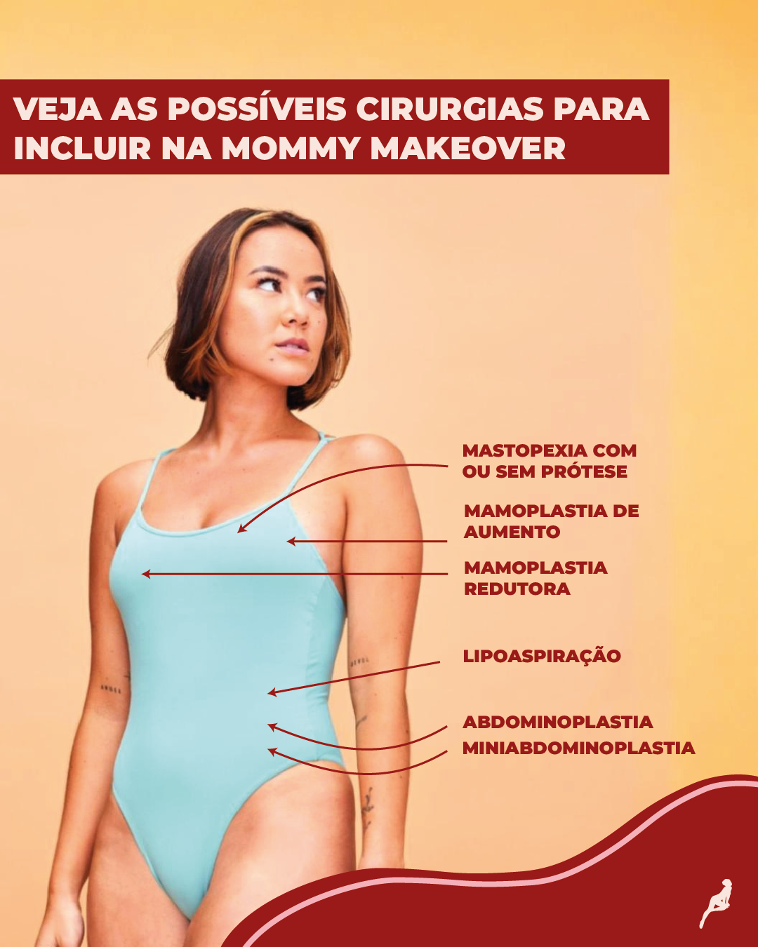 Quais cirurgias fazem parte do Mommy MakeOver? cirurgias incluídas no mommy makeover